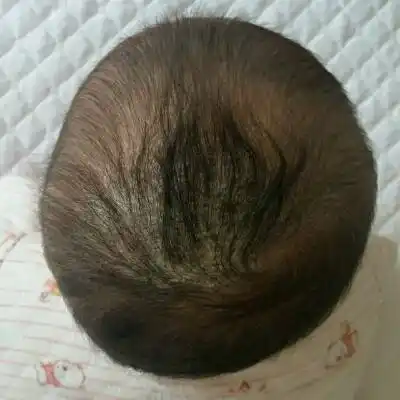 问答 婴儿期0-1岁 宝宝树孕育 90%的妈妈正在使用 宝宝树孕育 90%的