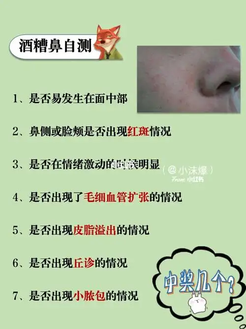 超实用的酒糟鼻护肤手册92科普小知识_护肤_解酒_日常生活_熬夜