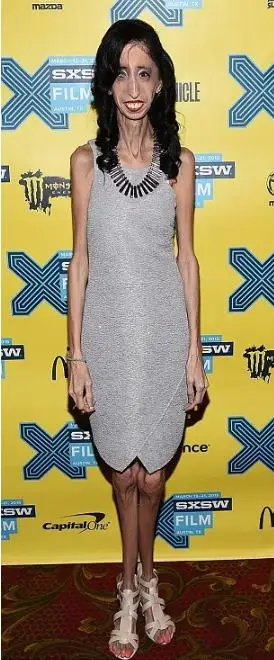 "世界最丑女人" 天生零脂肪不到60斤重_世界最丑女人_怀恩纪念网