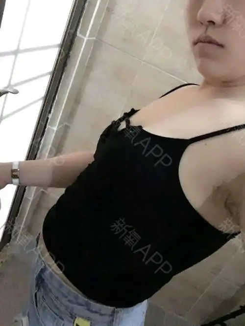 天线宝宝宝宝美丽日记-新氧美容整形