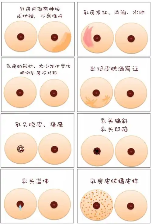 发现乳房肿块一定要手术吗?