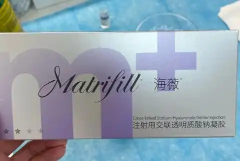 海薇玻尿酸适合打哪里