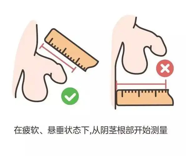 男宝私处说明书:包皮,蛋蛋,小 jj,这些问题必须得知道