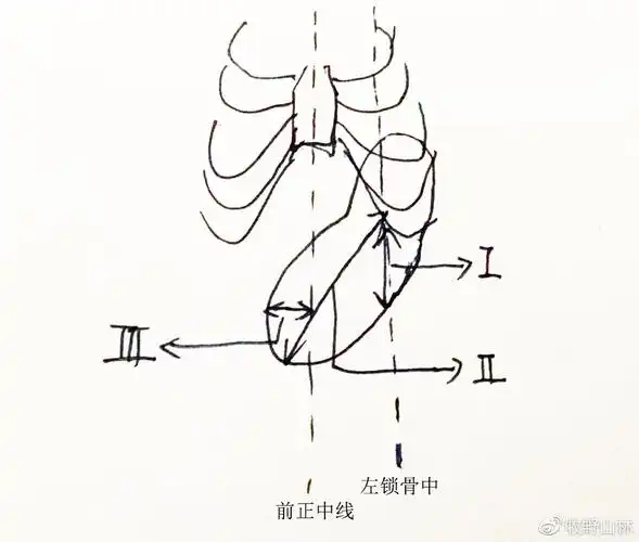 脾大是什么原因引起的?你可曾想过