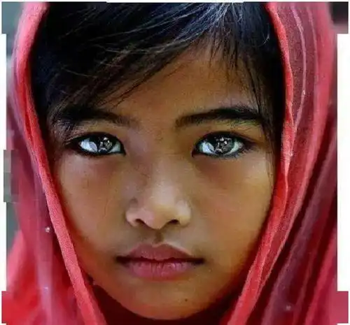 这个女孩的眼睛颜色是不同的,一个是黑棕色,一个是天蓝色,这是患有