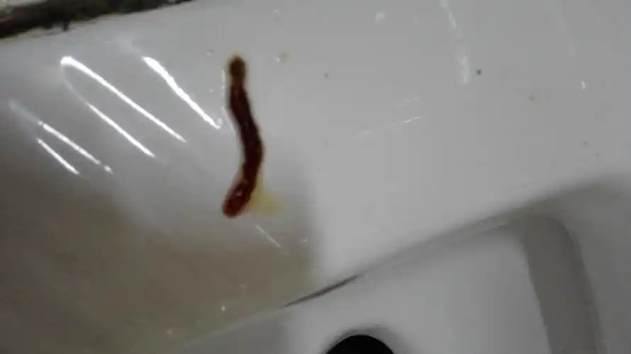 大便拉出一条类似虫子的东西