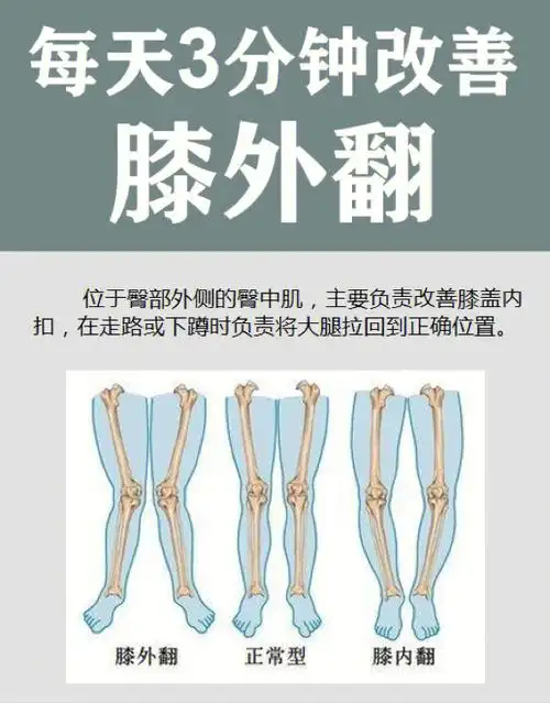 每天3分钟改善膝外翻