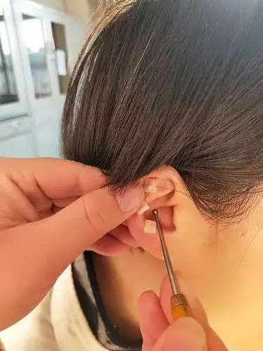 2018-2019年三九贴穴位贴敷即将开始啦!(清徐县人民医院*中医科)