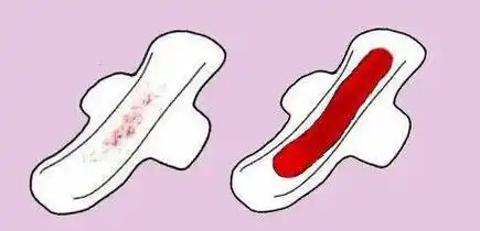 正常情况下,女性每次月经的出血量在30~50ml.