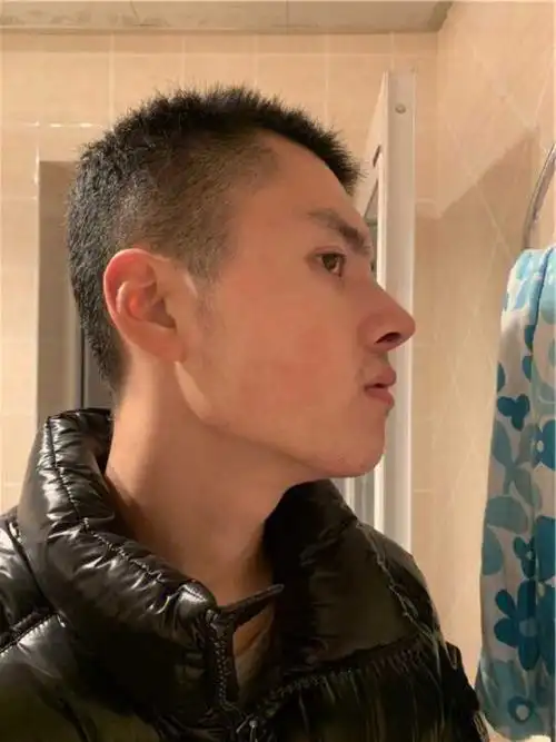 成都华美做鼻子后无处安放的魅力