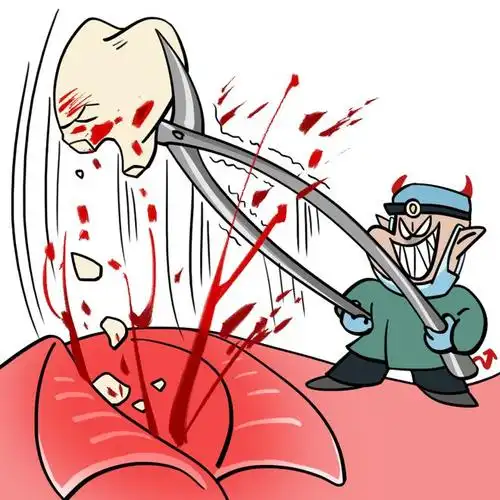 拔智齿的注意事项,必须知道|拔牙|冠周炎|牙髓炎|牙疼_网易订阅