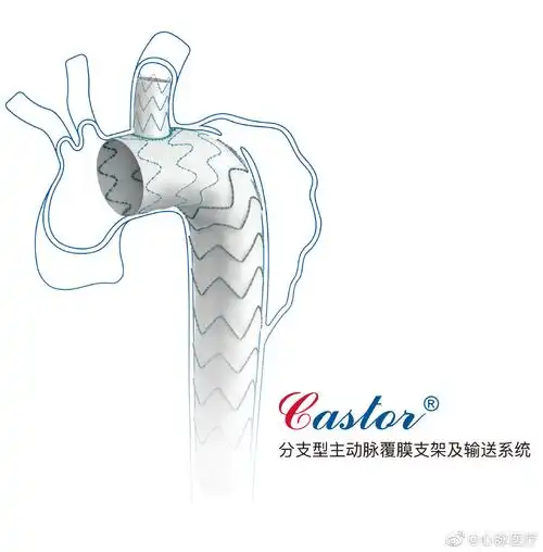心脉医疗castor分支型支架成功入选国