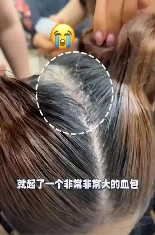 戚薇新发型惊艳亮相!假发太重扯得头皮疼,难道被假发薅秃头了?