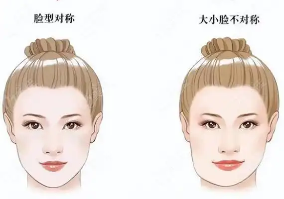 正常脸与大小脸对比