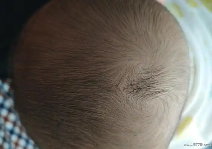 头上的旋是怎么形成的,头上的旋有什么说法吗?_生活_热文推