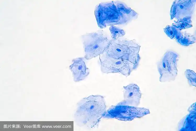 口腔内部的组织被称为基底粘膜,由鳞状上皮细胞组成.教育病理.