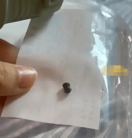 广州:一女子脸上有一个硬块,竟是……_铅弹_孩子_东西