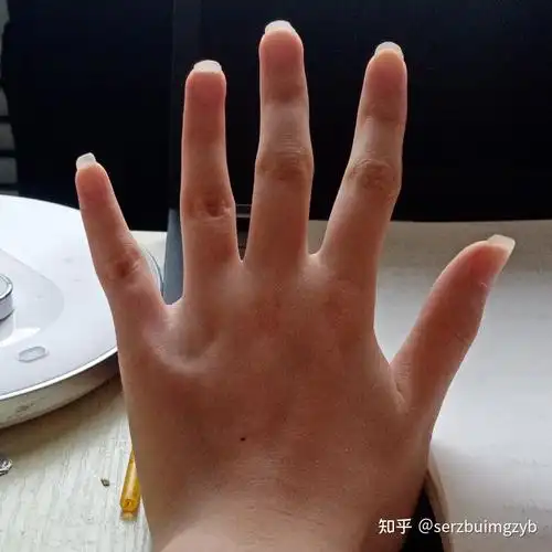 有同款歪手指吗