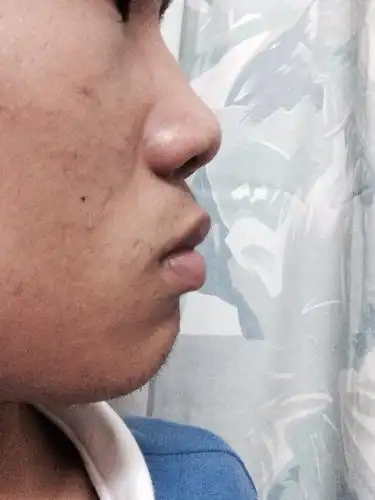 这个鼻梁算不算低 如果是那想要高鼻梁怎么办