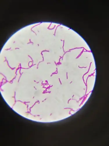 请问这种乳酸杆菌排成一队像一个长的杆菌的情况学名如何称呼?