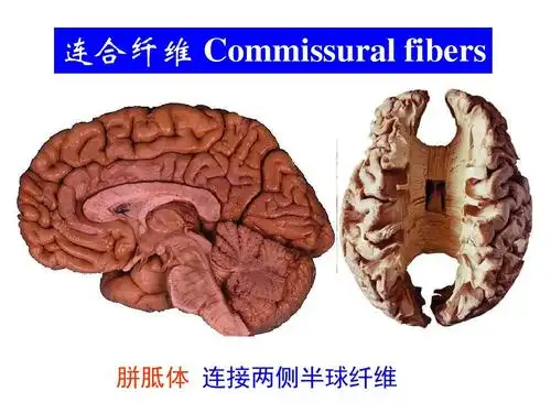 私人医生(医学百事通)-端脑内部构造脑膜脑血管及脑脊液循环ppt
