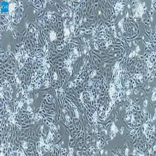 前列腺上皮细胞