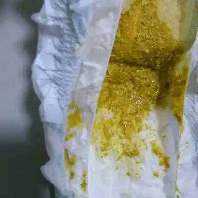 二个月的宝宝拉这种屎,是消化不良吗?急需回答