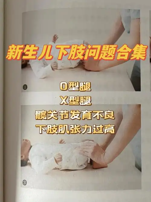 新生儿髋关节发育不良自测