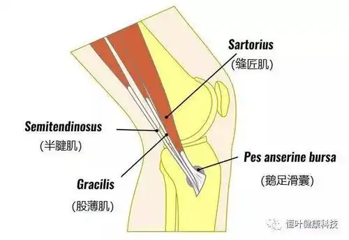鹅足腱滑囊炎你知道多少