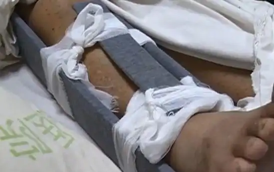 比较严重,不过经过检查,头脑没有什么问题,另外就是腿部有两处骨折