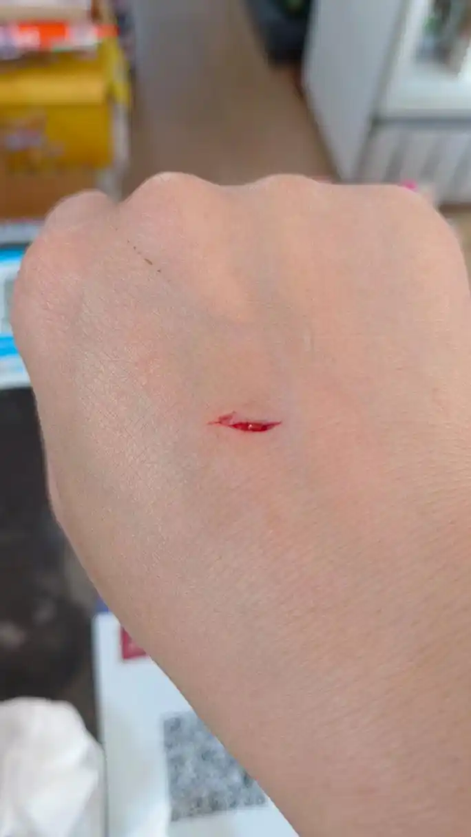 今天干活把手给划破长口子😫吓到我了[大哭]我一