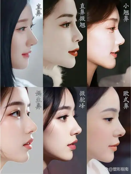 130°左右,鼻背呈一条直线,鼻尖较精致 2直鼻微翘 山根