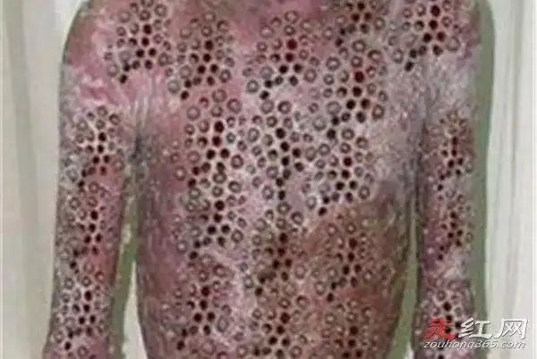 毛孔芝麻女孩恐怖图片故事这是一个恐怖片