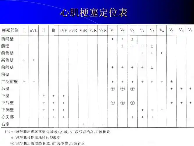 心肌梗塞定位表ppt