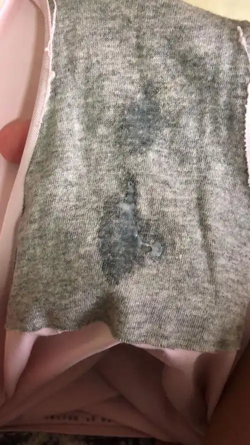 白带这样怎么回事?