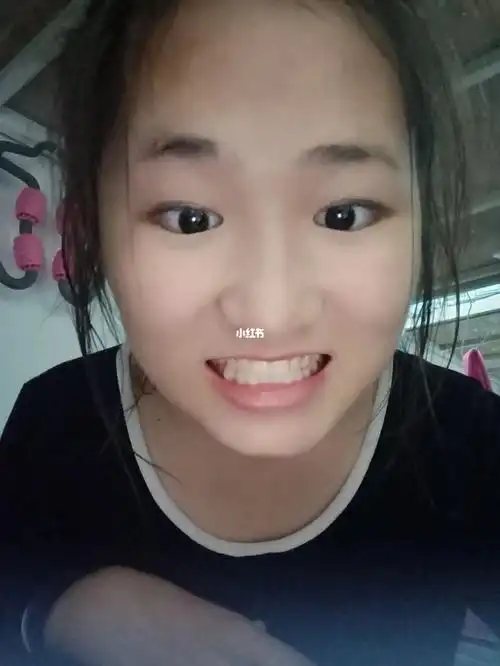 面中部凹陷,笑起来很僵硬_生活记录_接地气生活