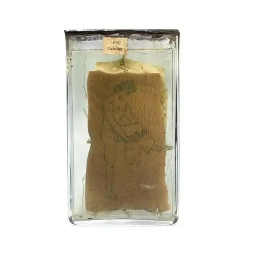 波兰的人皮纹身标本