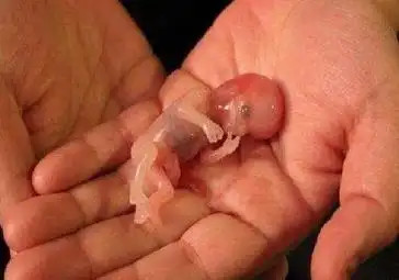 为了女性的身体着想,很多时候,她们都会选择尽早将胎儿打掉,这样伤身