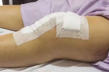 联合绷带膝关节手术在照片