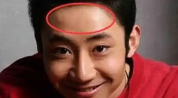 额头在相学中代表的是男人的祖业的象征,而额相长得端正,额头宽广高耸