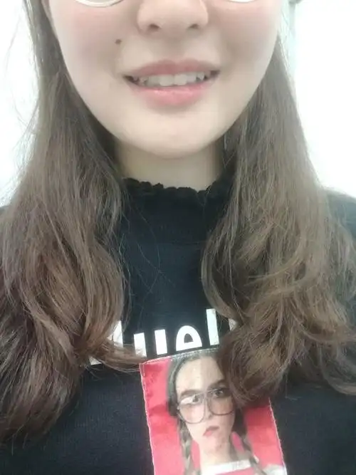 这样的牙齿咬合正常吗,我觉得自己的上颌有点突出,笑起来也露不出牙齿