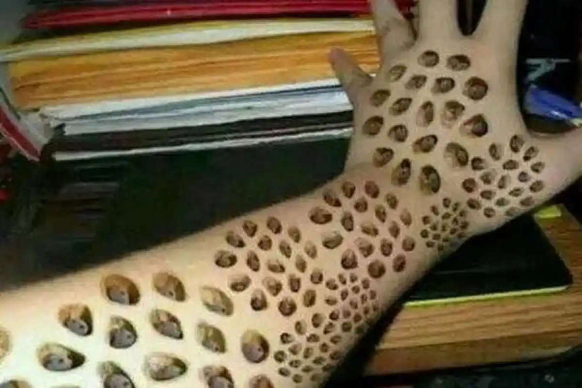 来,芝麻女孩,密集恐惧症别进