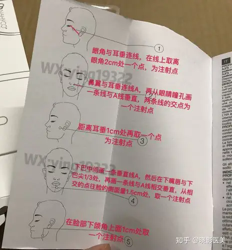 5cm处,定为注射点四距离耳垂1cm处取一个注射点三鼻翼与耳垂