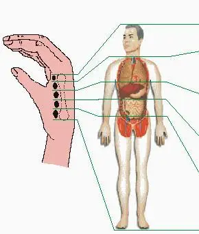 第二掌指骨侧全息疗法