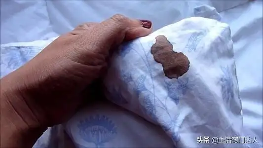 衣服有血迹怎么才可以洗掉(教你一招血渍轻松溶解下来)