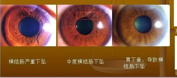 手诊面诊色诊如何通过虹膜学来诊断健康