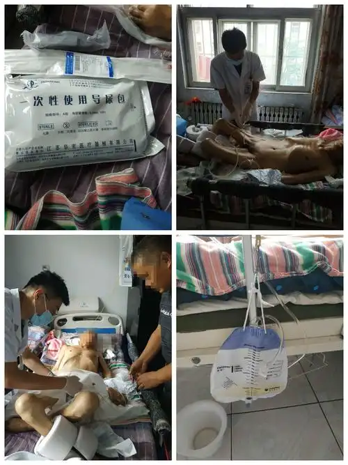 为普集医院宿舍患者更换三腔导尿管