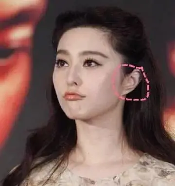 在耳朵的风水里,面相大师们会管她这种耳朵叫鸡嘴耳,就是耳朵的耳垂尖