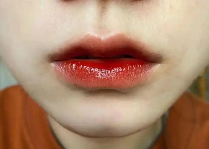 唇毛去除大作战怎么才能获胜呢