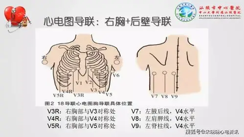 心肌梗死,心律失常,异常心电图大盘点!_手机搜狐网